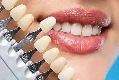 هزینه هر واحد لمینت هزینه هر واحد لمینت