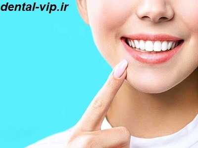 راه های سفید کردن